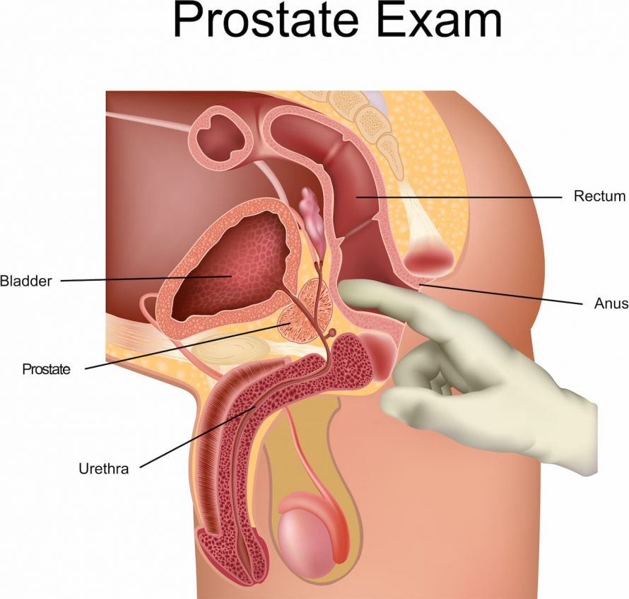 prostata screening österreich